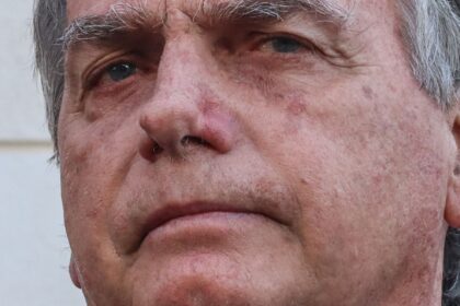 equipe-medica-de-bolsonaro-descarta-complicacoes-pos-cirurgicas
